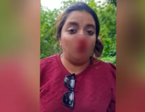 ओवर टेक करने पर शख्स ने महिला के मुंह पर मारा मुक्का