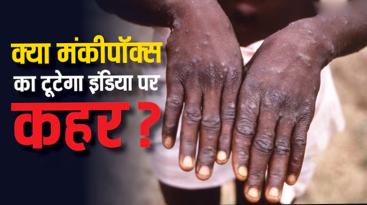 मंकीपॉक्स का पहला केस एशिया तक पहुंचा